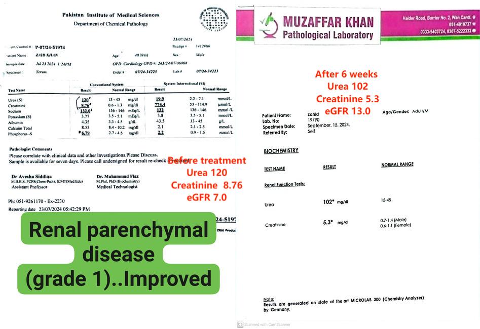 Zahid’s Journey: How Homeopathy Helped Restore His Kidney Function